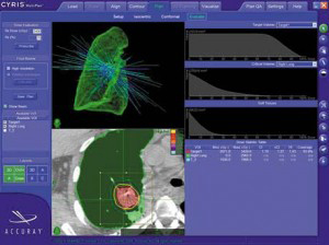 CyberKnife®