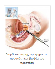Διορθωτικό υπερηχογράφημα του προστάτη και βιοψία του προστάτη